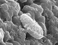 Electron microsope picture of possible fossilized bacteria (NASA photo)